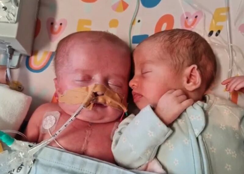 La petite chanceuse : une petite fille à qui l'on avait donné 30 minutes à vivre fête son premier anniversaire