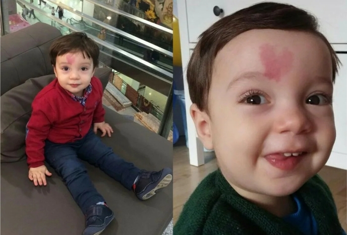 Un enfant né avec une marque de naissance en forme de cœur sur le front : à quoi ressemble-t-il aujourd'hui