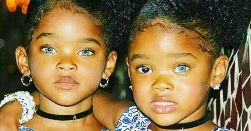 Ces deux fillettes ont été considérées comme « les plus merveilleuses jumelles du monde » : leurs photographies fascinent l'Internet
