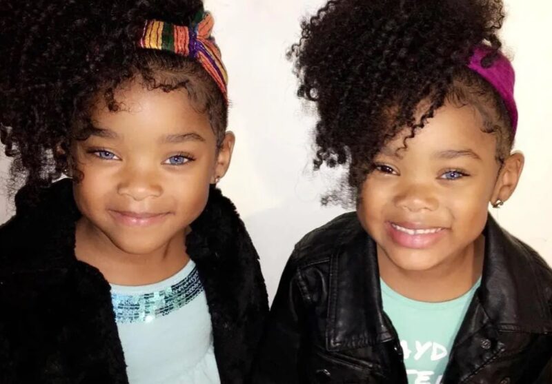 Ces deux fillettes ont été considérées comme « les plus merveilleuses jumelles du monde » : leurs photographies fascinent l'Internet