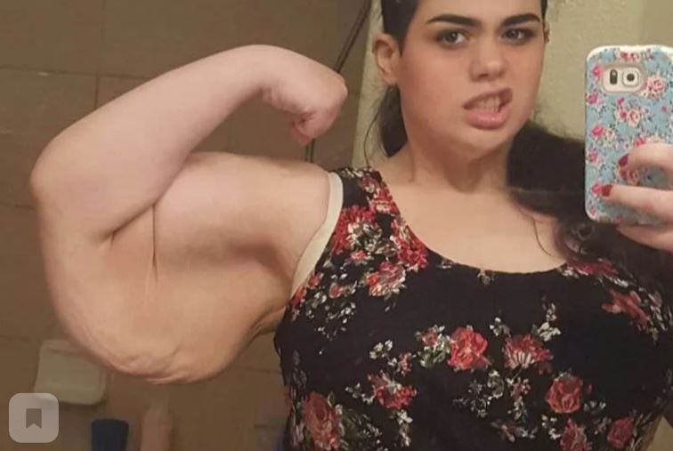 À quoi ressemble une jeune fille qui a perdu 200 kilos et qui est devenue une star de l'Internet grâce à son énorme poids ?