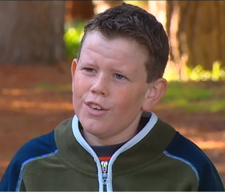 Ce garçon est né en 1993 avec une peau plissée comme celle d'un enfant de 5 ans