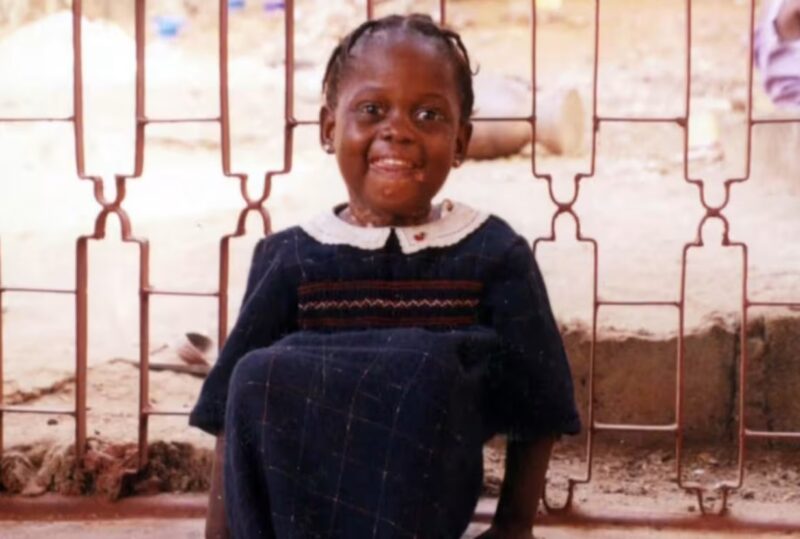 Un couple décide d'adopter une jeune fille rejetée pour son apparence, et la voilà devenue une star mondiale