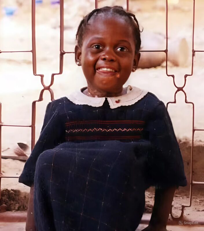 Un couple décide d'adopter une jeune fille rejetée pour son apparence, et la voilà devenue une star mondiale