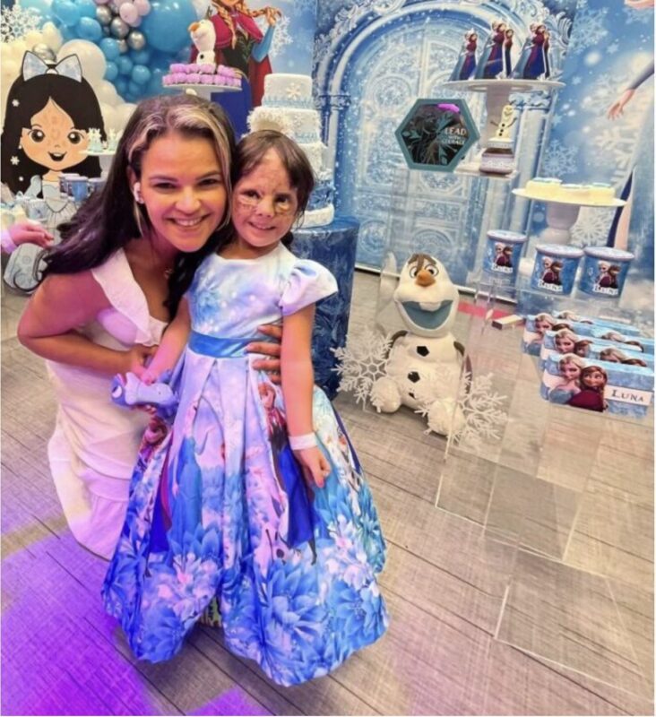« La fille Batman a grandi » : Découvrez cette jeune fille née avec un "masque"