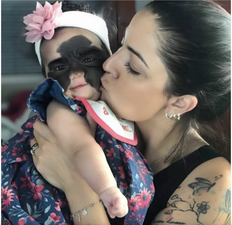 « La fille Batman a grandi » : Découvrez cette jeune fille née avec un "masque"
