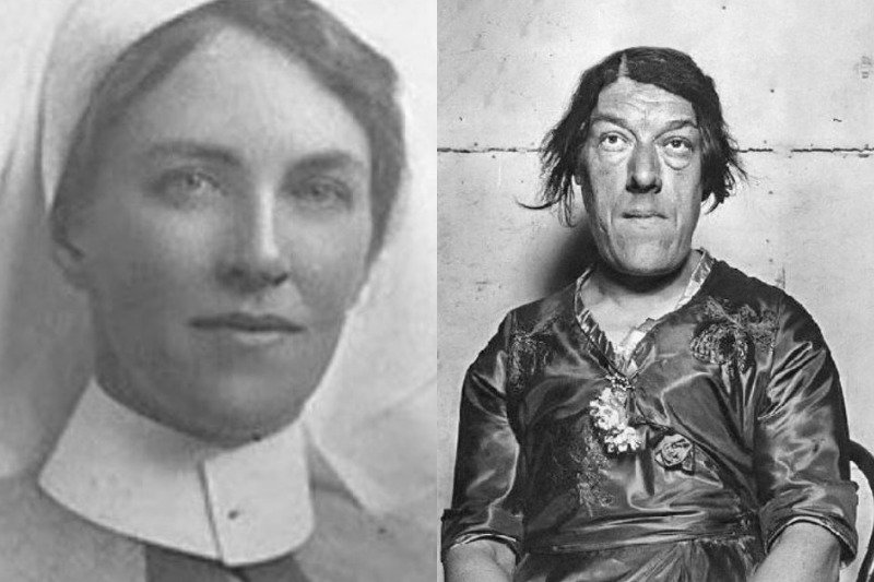 Mary Ann Bevan : le destin dramatique de la « dame la plus laide du monde »