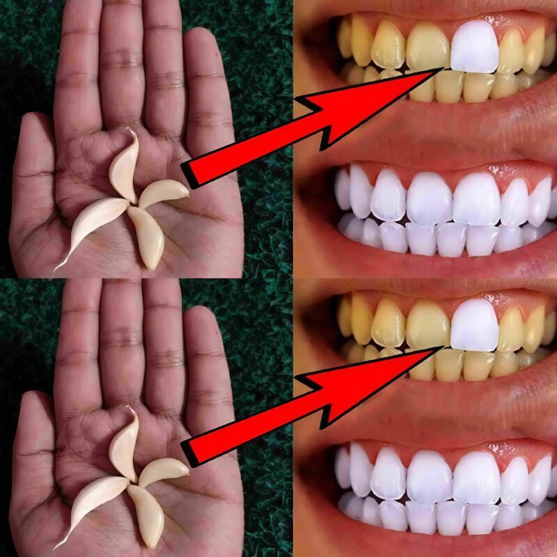 Comment blanchir efficacement les dents avec de l’ail – une méthode naturelle et surprenante pour un sourire plus blanc et éclatant