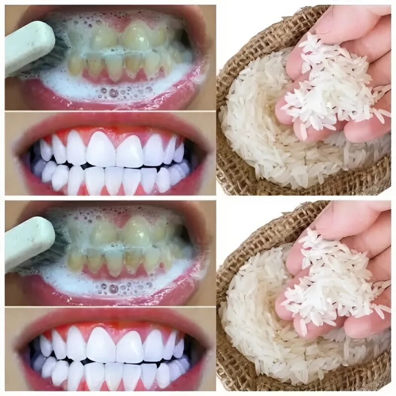 L’astuce méconnue à base de riz pour des dents plus blanches en un rien de temps !