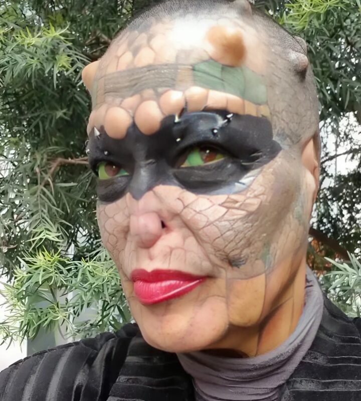 Elle fait enlever ses oreilles et son nez pour devenir « dame dragon » et affirme être née reptilienne