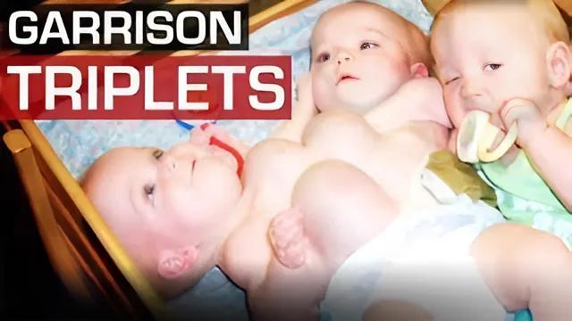 Trois sœurs nées triplées, dont deux siamoises, abandonnées à la naissance… Regardez-les 18 ans plus tard