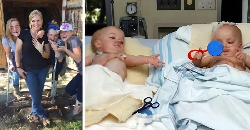 Trois sœurs nées triplées, dont deux siamoises, abandonnées à la naissance… Regardez-les 18 ans plus tard