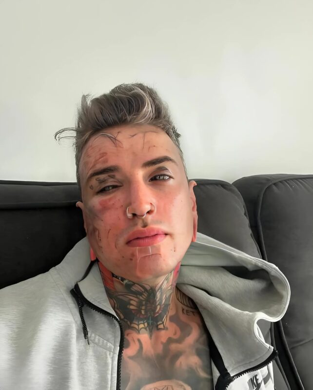 Il efface ses tatouages pour sa fille : la transformation bouleversante d’un jeune père